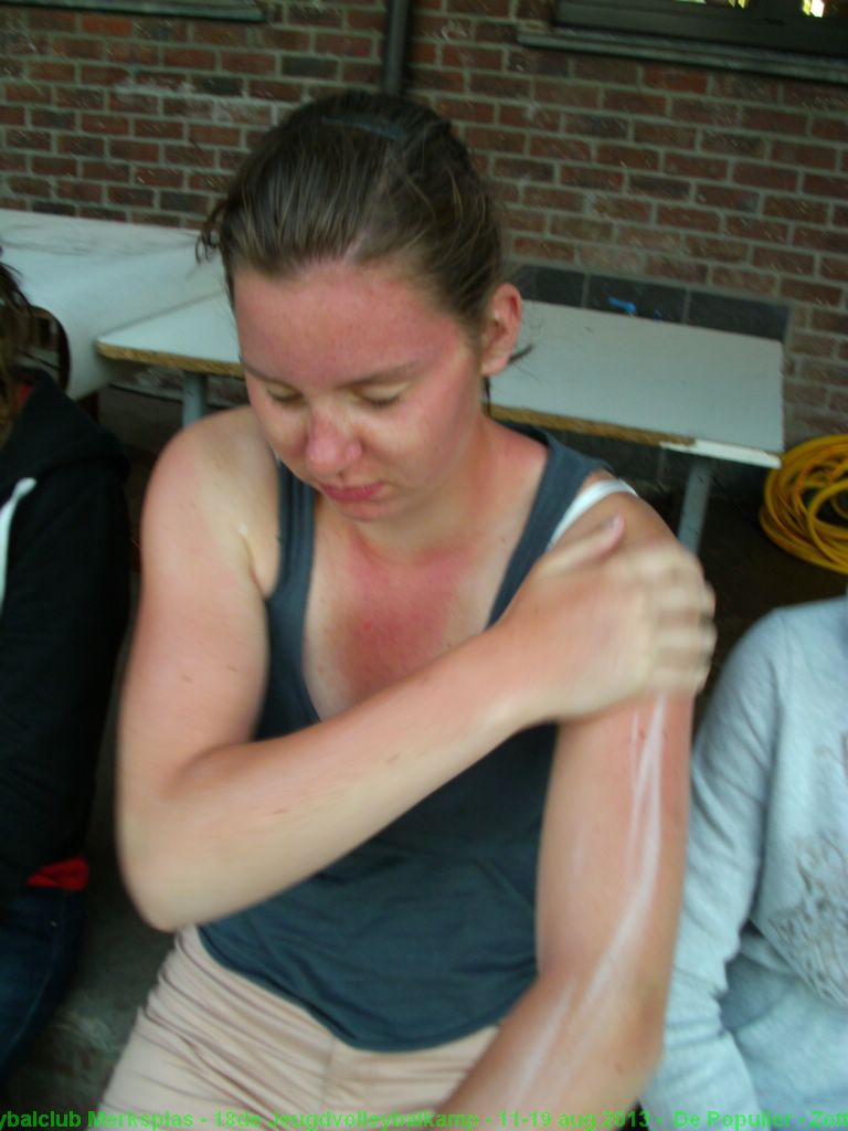 Rood verbrand van de fietstocht (ondanks het veelvuldige smeren met zonnemelk).